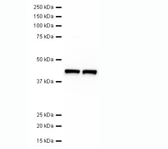 植物抗β-Actin單克隆抗體 MAN1011-100ul